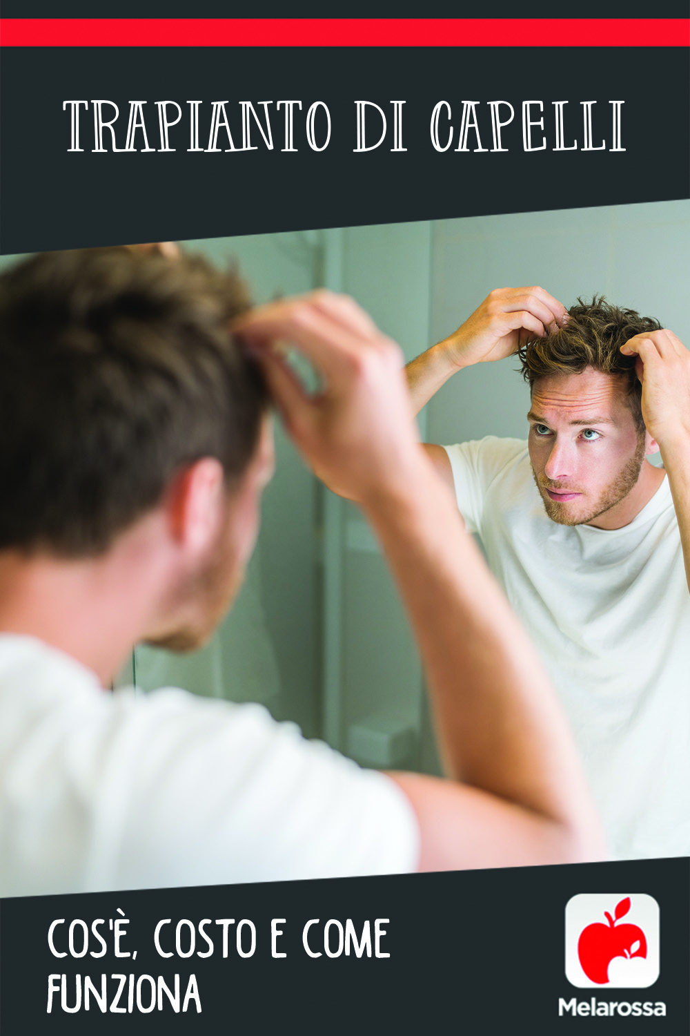 Trapianto capelli: cos'è, costo e come funziona 6 trapianto di capelli