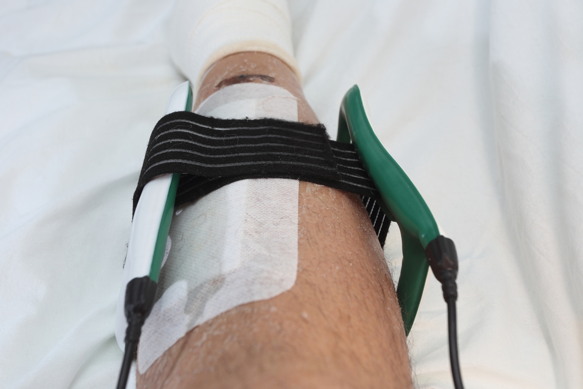 Magnetoterapia: cos’è, come funziona, a cosa serve, benefici, i migliori macchinari, controindicazioni 1 benefici della magnetoterapia