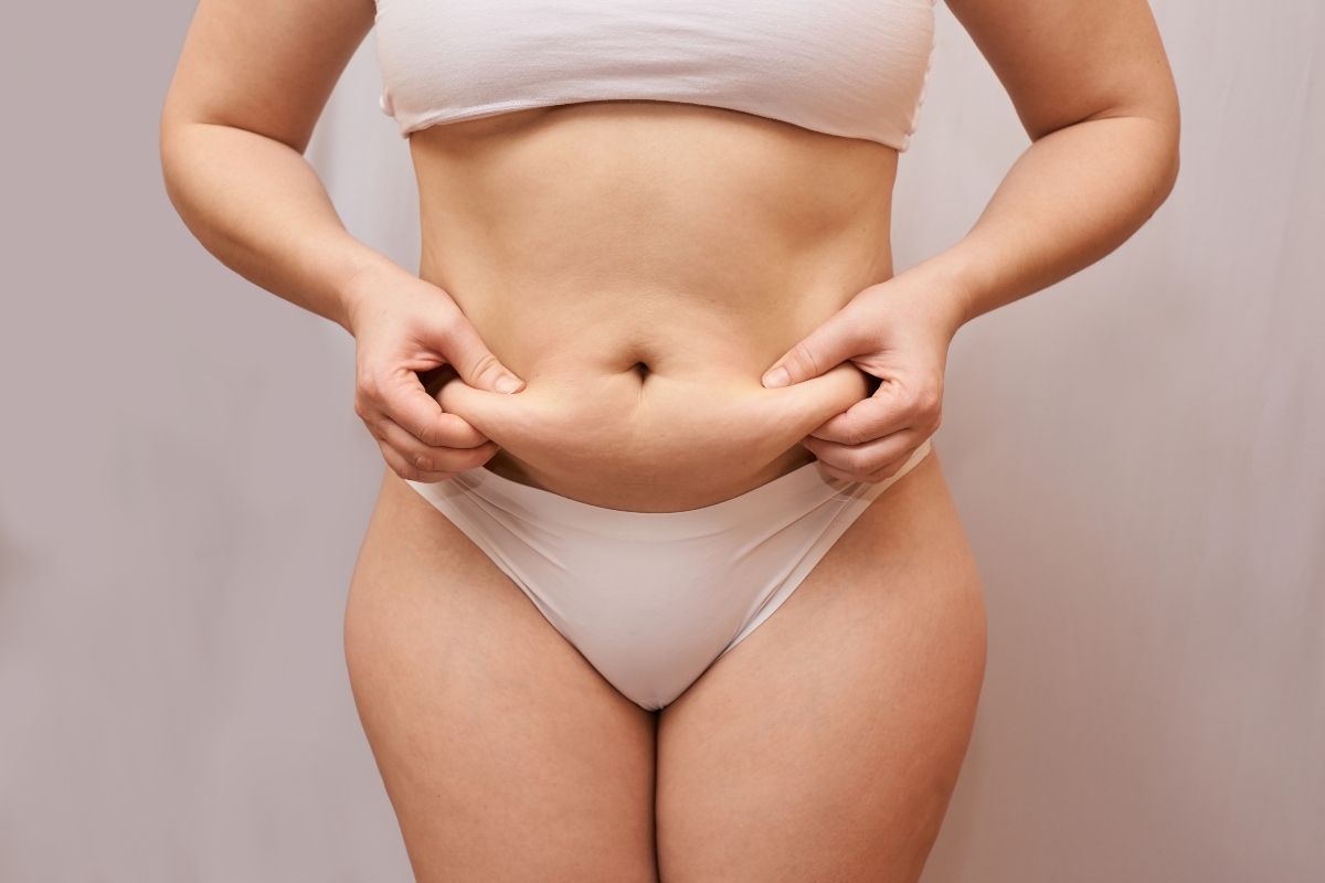 Cellulite: cos'è, quali sono le cause e i rimedi principali 3 cellulite e ritenzione idrica: differenze