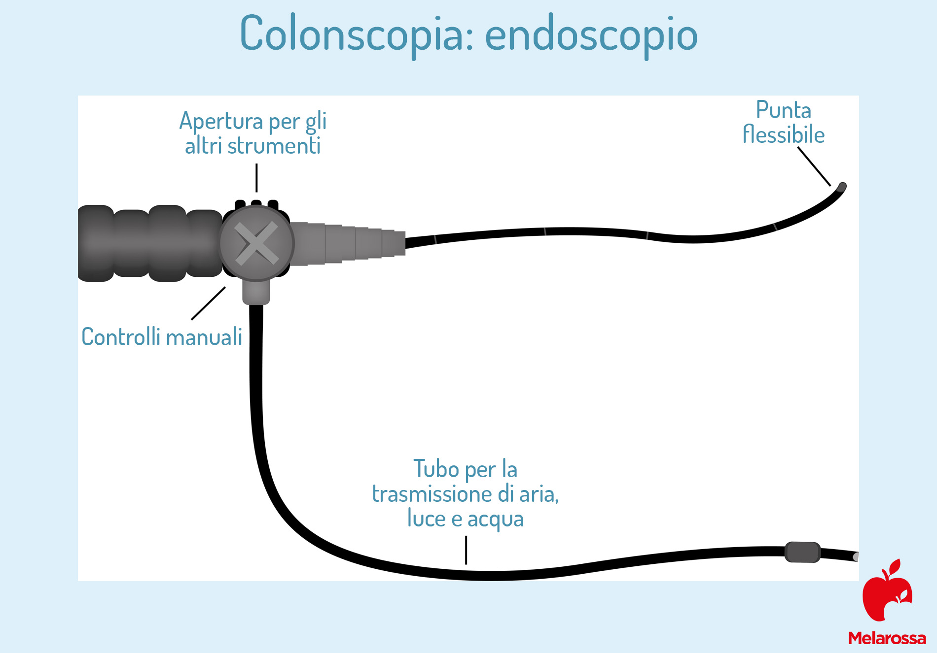 Colonscopia: cos’è, cosa si vede, a cosa serve e quanto è dolorosa 2 colosnscopia: com'è fatto endoscopio