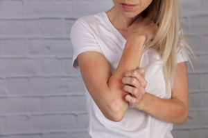 Dermatite da stress: cos&rsquo;&egrave;, cause, sintomi, rimedi e cura