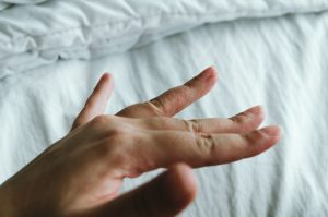 Disidrosi a mani e piedi: cos&rsquo;&egrave;, cause, sintomi, terapia e rimedi