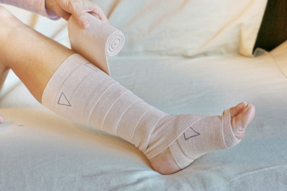 Flebite: cos'è, sintomi, chi rischia di più, prevenzione e come curarla 4 flebite: complicanze