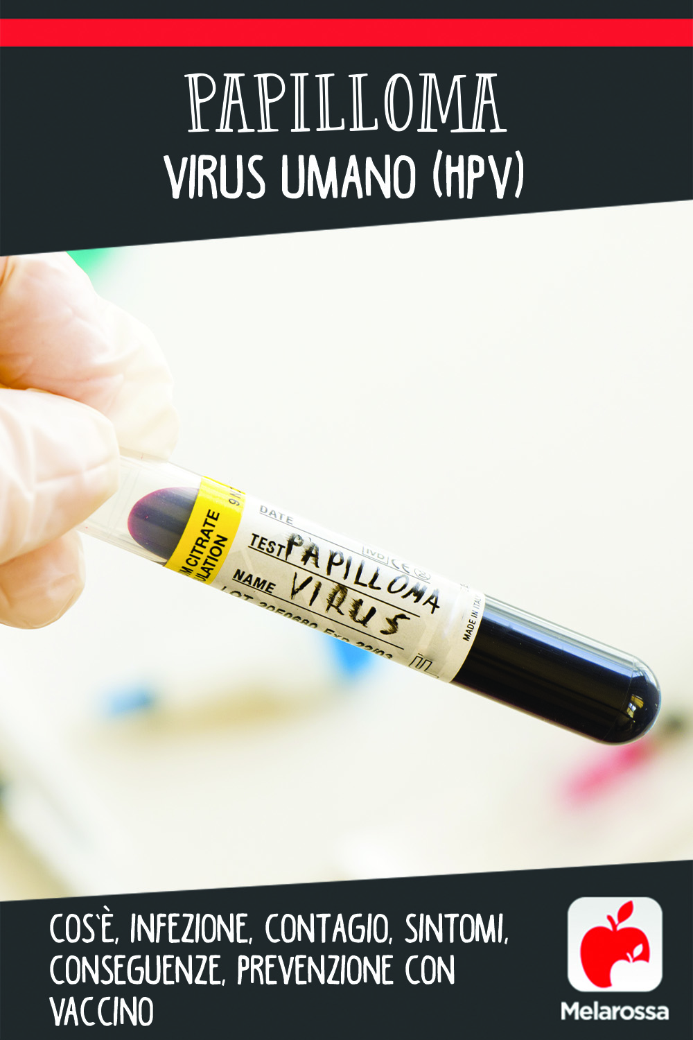 Papilloma virus umano (HPV): cos'è, infezione, contagio, sintomi, conseguenze, prevenzione con vaccino 11 papilloma virus: cos'è, contagio, cause, sintomi, cure e prevenzione