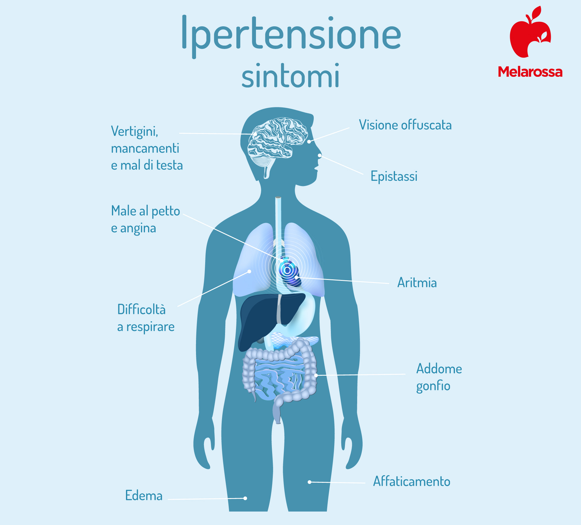 Ipertensione: che cos'è, valori, cause, sintomi e cura 2 sintomi dell'ipertensione