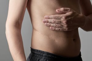 Pielonefrite: cos&rsquo;&egrave;, sintomi, cause, diagnosi, cura e prevenzione