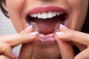 Bruxismo: cos&rsquo;&egrave;, cause, sintomi, che tipo di bite scegliere, cure e rimedi naturali