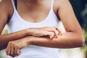 Dermatite erpetiforme: cos&rsquo;&egrave;, cause e sintomi, diagnosi, complicanze e cure