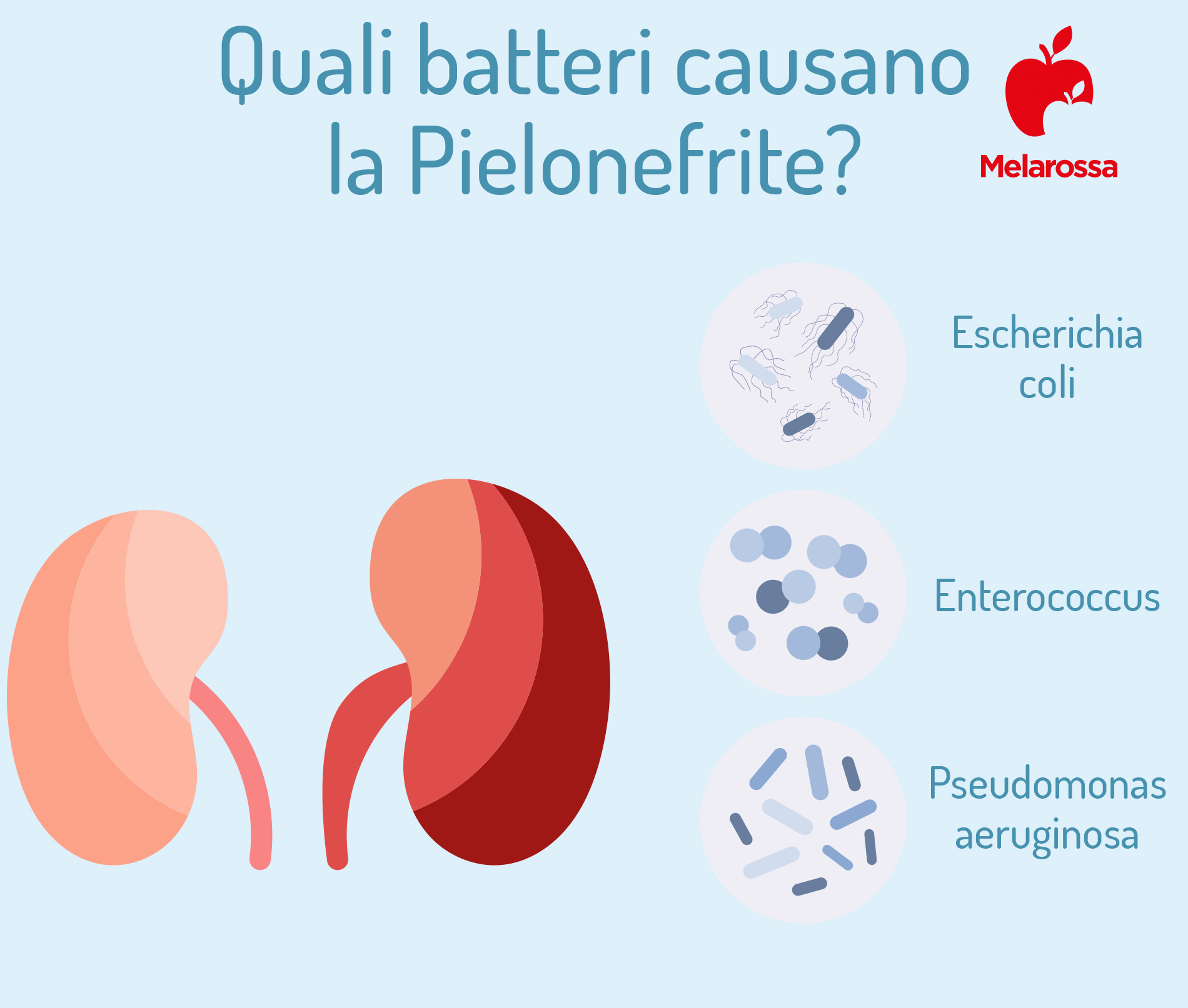 Pielonefrite: cos’è, sintomi, cause, diagnosi, cura e prevenzione 2 Pielonefrite: batteri
