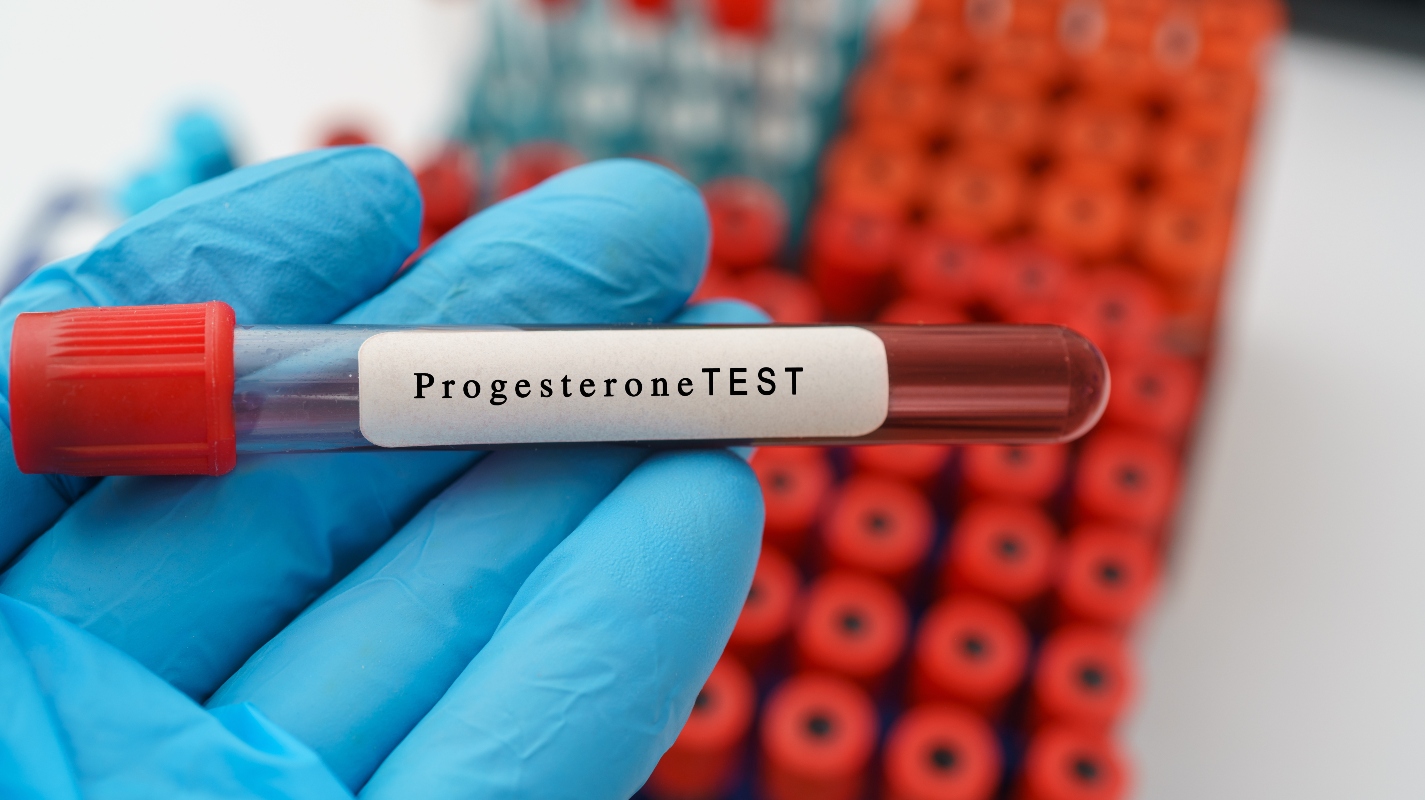 Progesterone: cos’è, a cosa serve, tabella di valori, cibi per aumentarlo, a cosa serve in gravidanza 3 progesterone in gravidanza: a cosa serve fare il test
