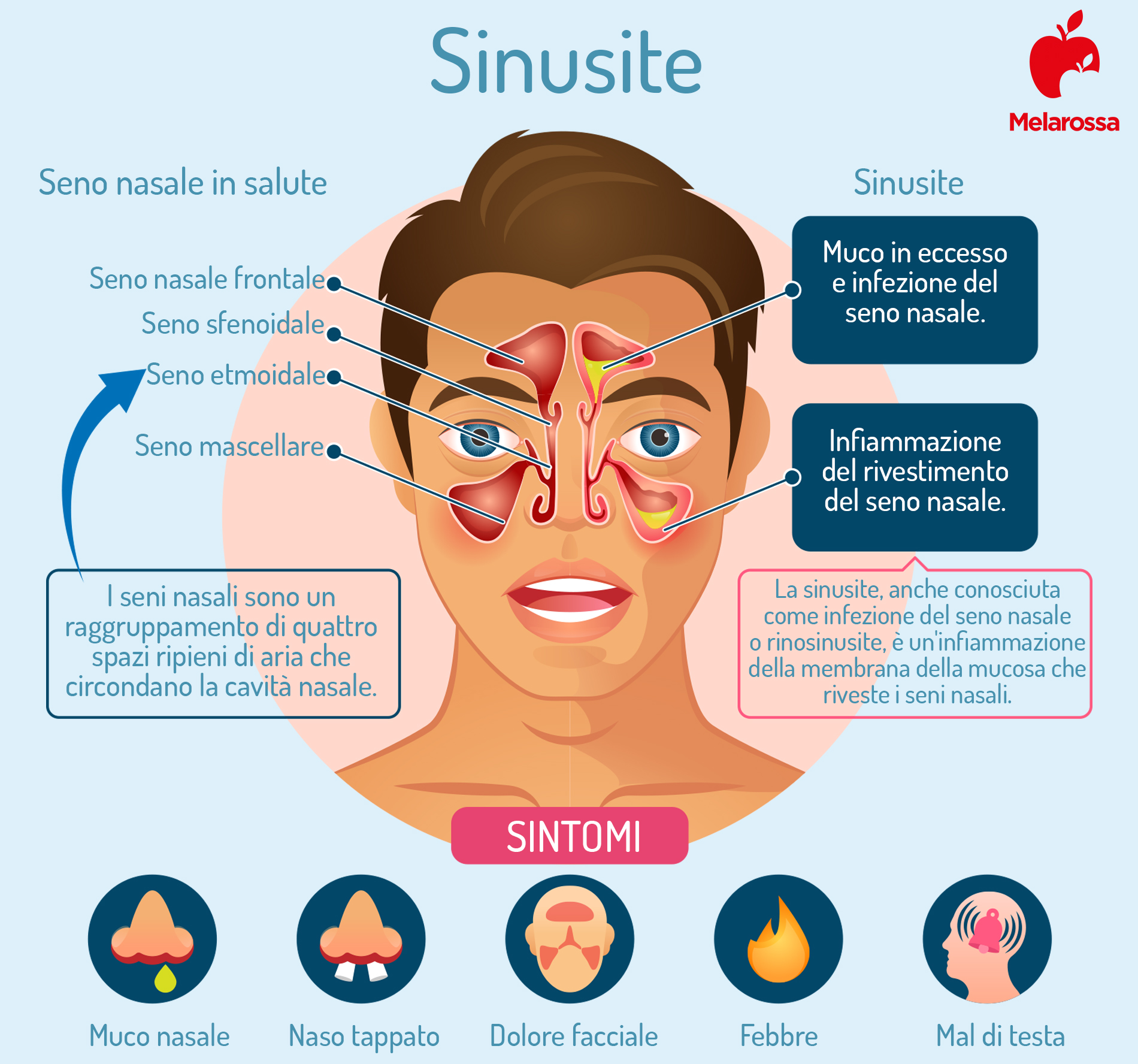 Sinusite: cos'è, sintomi, rimedi, cura e prevenzione 3 i sintomi della sinusite