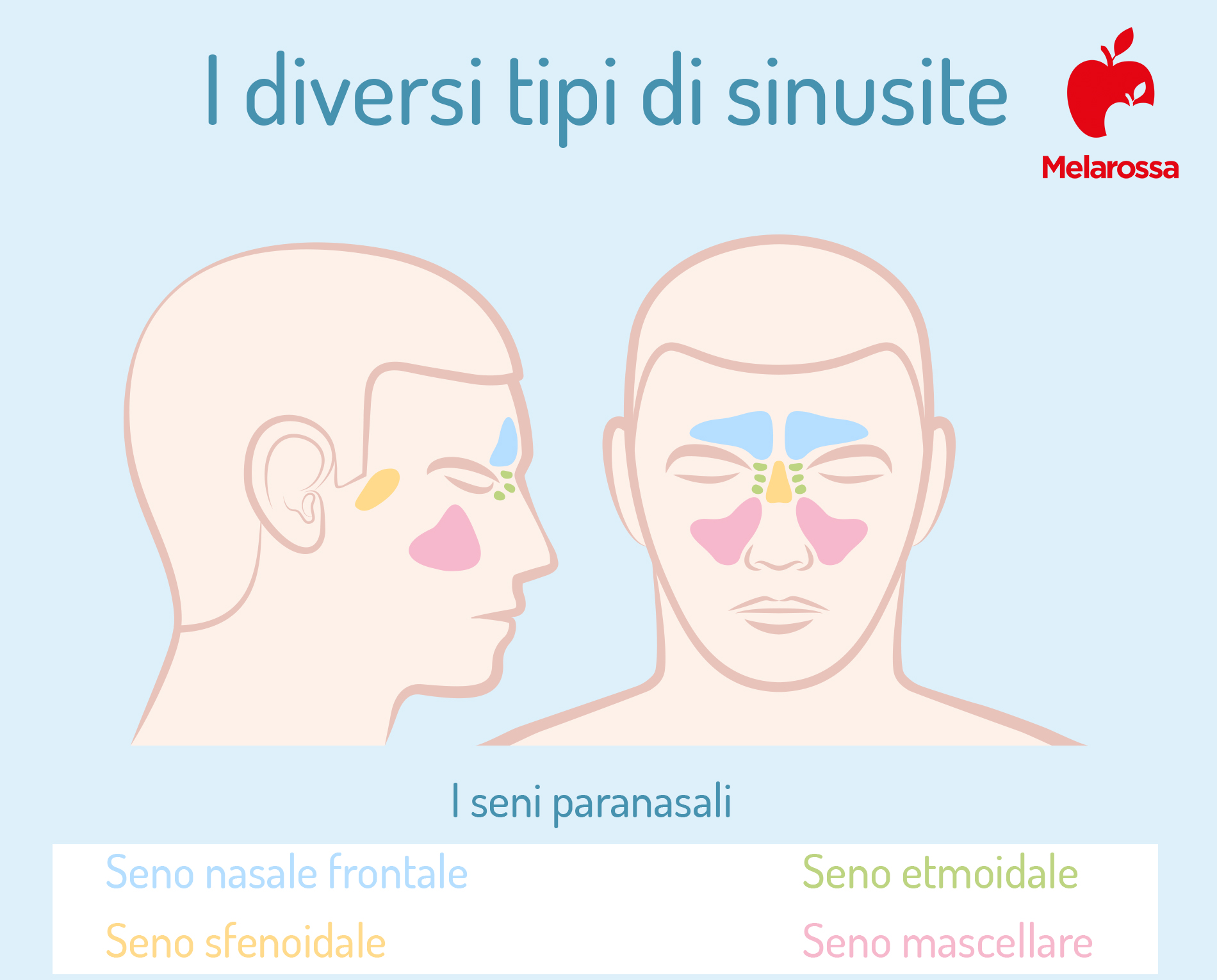 Sinusite: cos'è, sintomi, rimedi, cura e prevenzione 2 i diversi tipi di sinusite