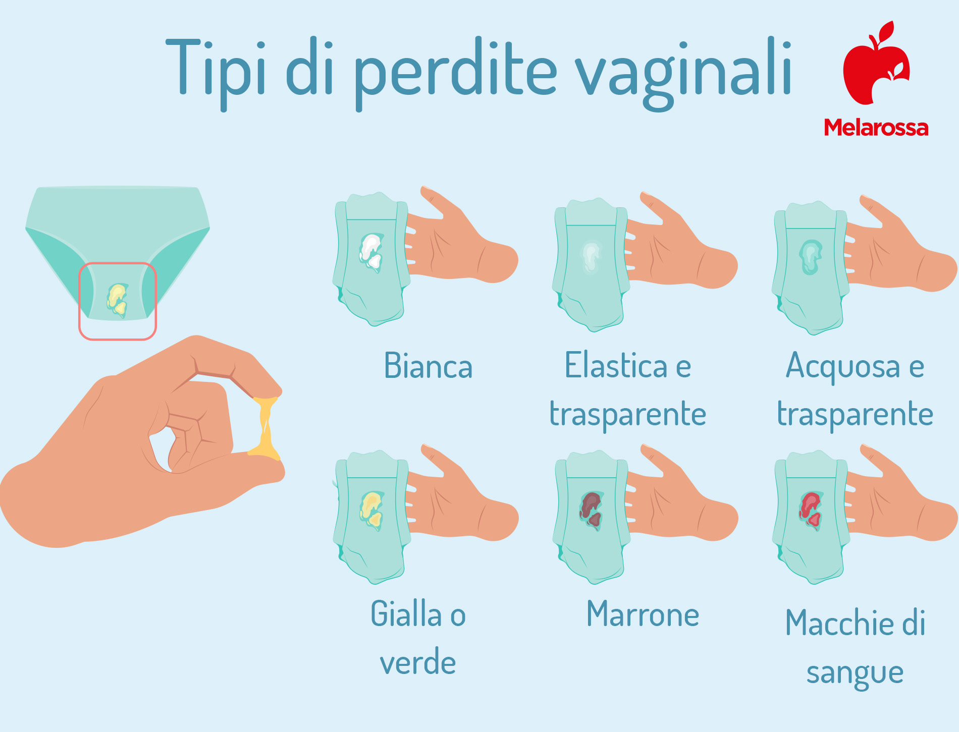 Vaginite: cos’è, tipi, cause, sintomi e trattamenti 5 vaginite: tipi di perdite vaginale