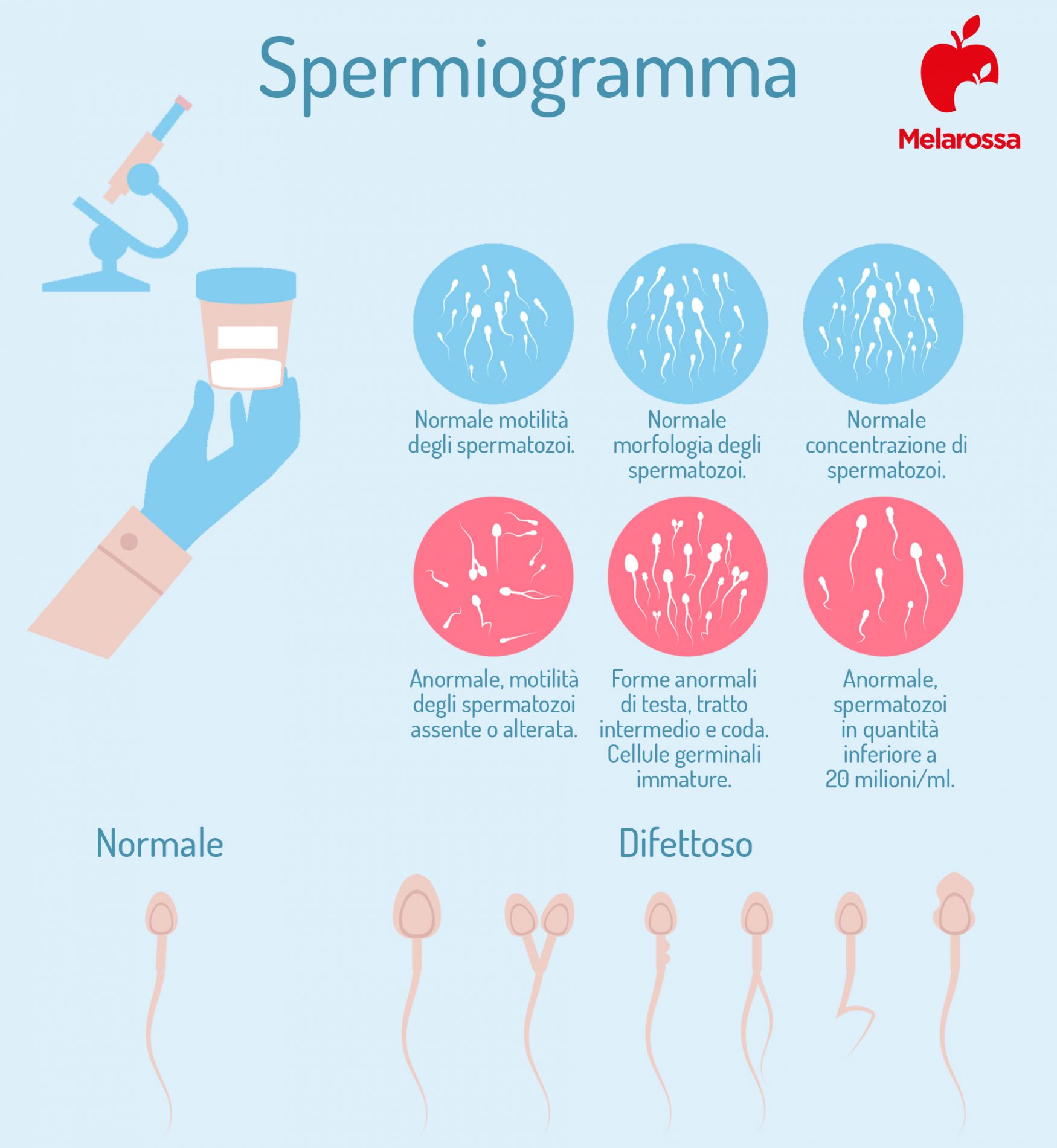 Spermiogramma: cos’è, come funziona, quando si esegue, risultati, diagnosi e costi 1 spermiogramma: che cos'è