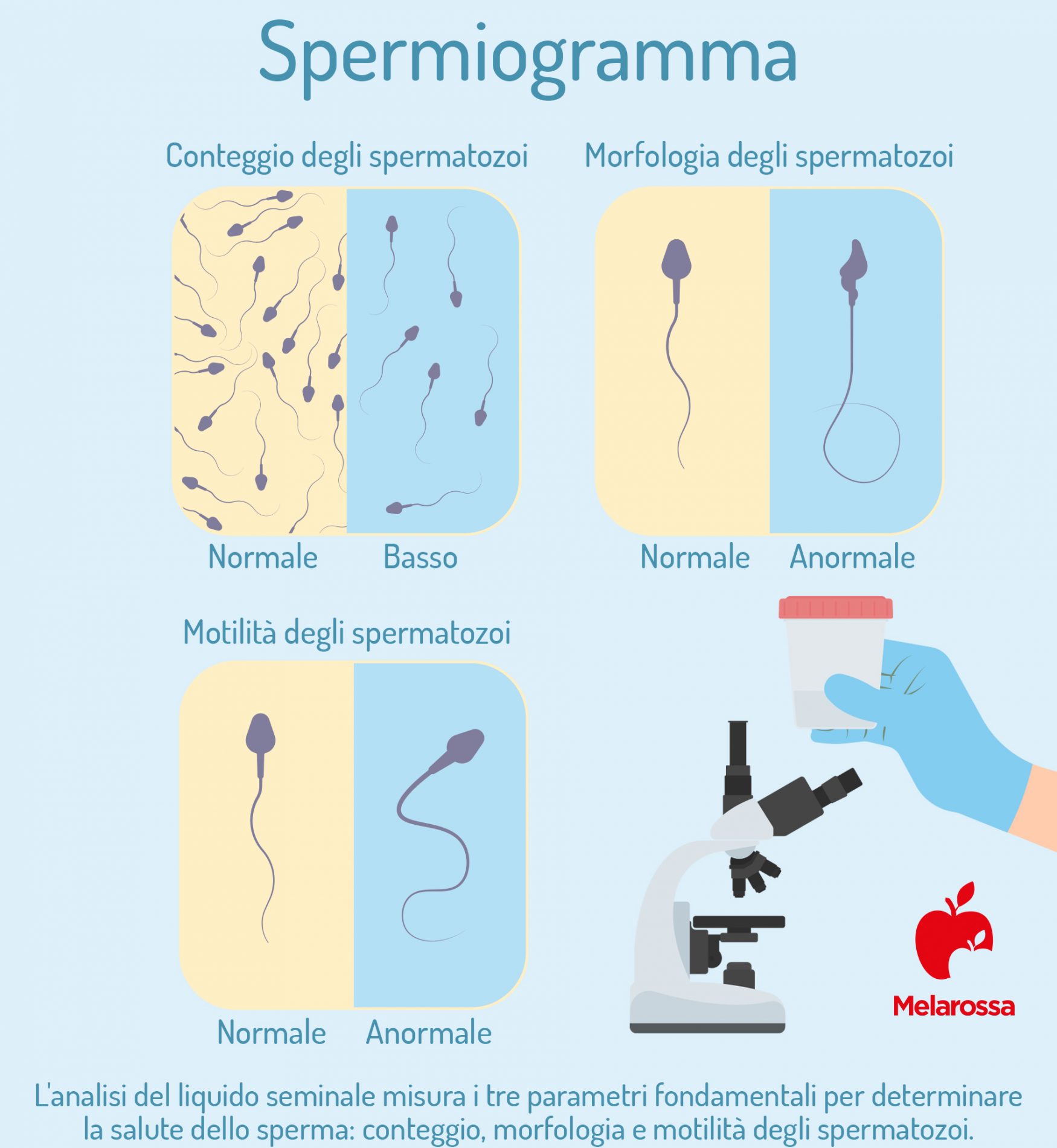 Spermiogramma: cos’è, come funziona, quando si esegue, risultati, diagnosi e costi 3 spermiogramma: analisi