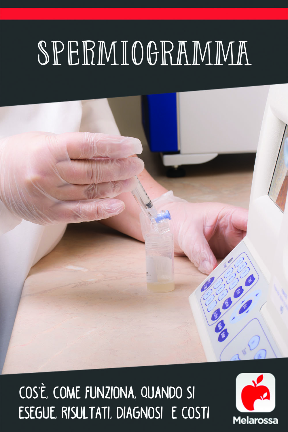 Spermiogramma: cos’è, come funziona, quando si esegue, risultati, diagnosi e costi 5 spermiogramma