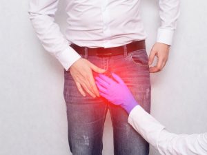 Varicocele: cos&rsquo;&egrave;, cause, sintomi, diagnosi e cura