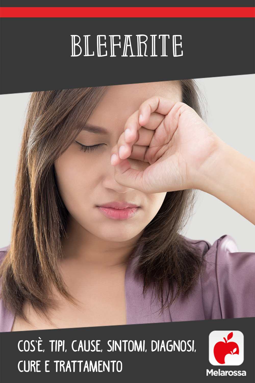 Blefarite: cos’è, tipi, cause, sintomi, diagnosi, cure e trattamento, prevenzione 7 blefarite