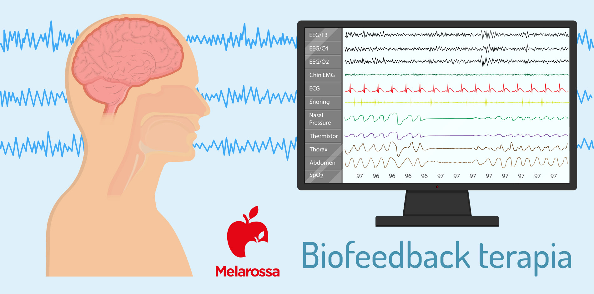 Cistite interstiziale: cos’è, sintomi, cause, cure e decorso 6 cistite intersiziale, biodfeedback terapia