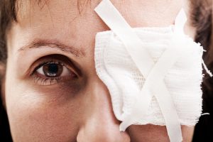 Diplopia monoculare e binoculare: che cos&rsquo;&egrave;, cause, tipi, sintomi, diagnosi e cure