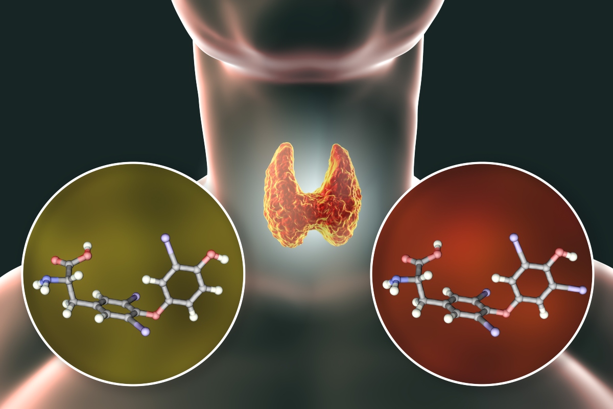 Ipertiroidismo: cos'è, cause, sintomi, diagnosi, cure e dieta 1 ipertiroidismo- ormoni