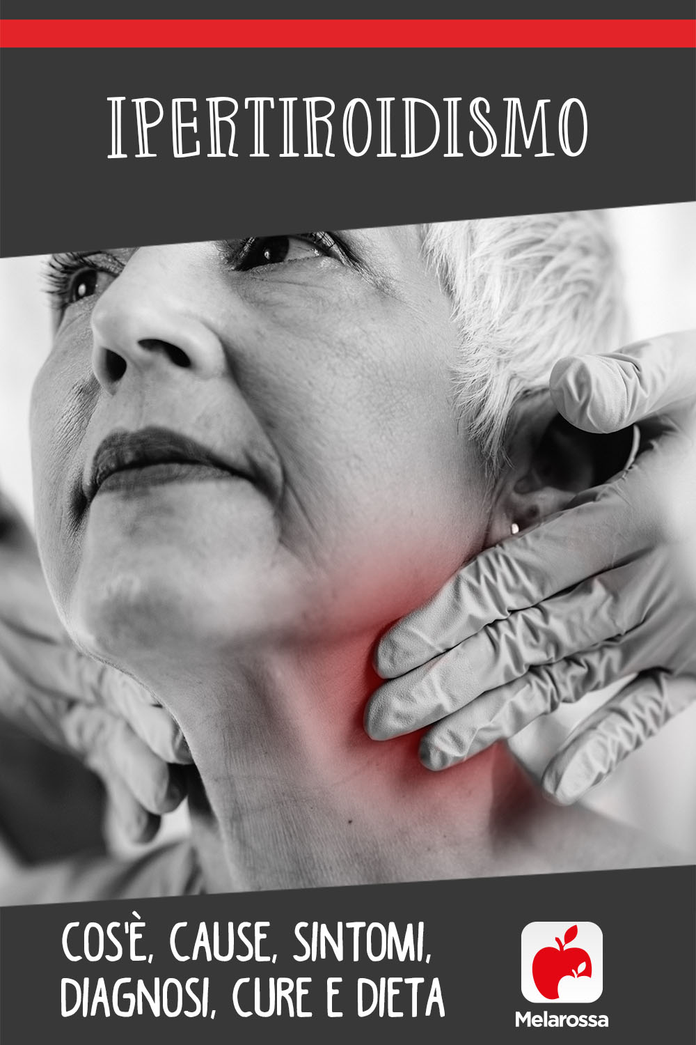 Ipertiroidismo: cos'è, cause, sintomi, diagnosi, cure e dieta 9 ipertiroidismo: cos'è, cause, sintomi, diagnosi e cure