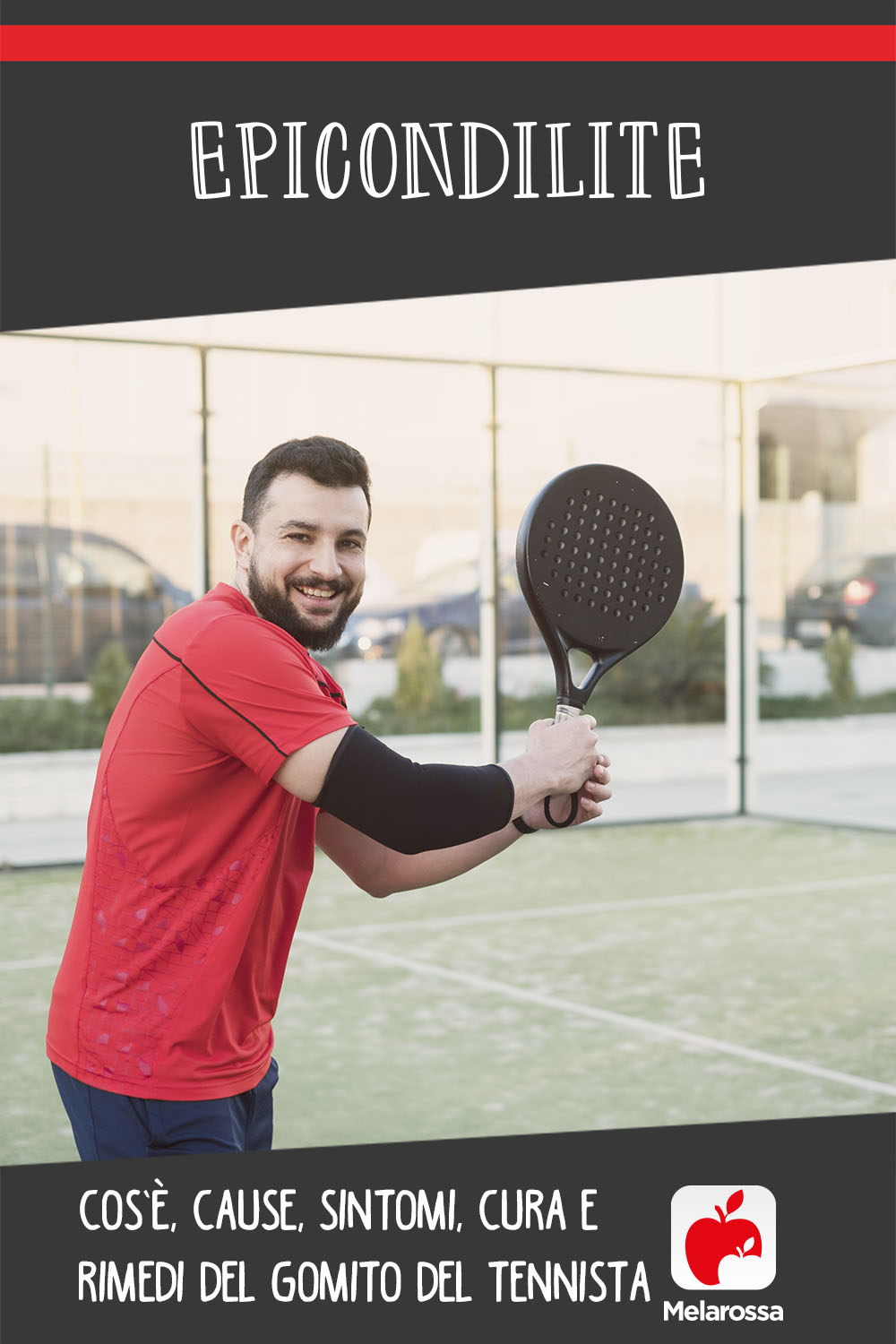 Epicondilite: cos’è, cause, sintomi, cura e rimedi del gomito del tennista 5 epicondilite