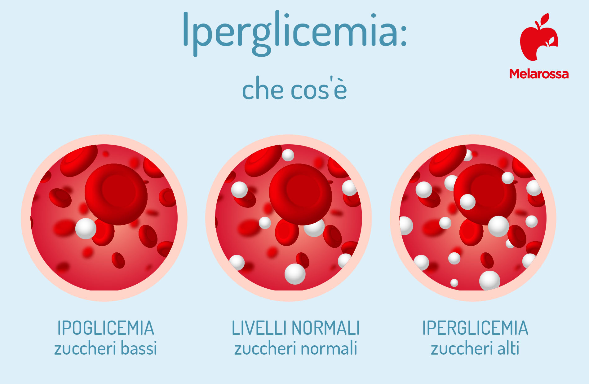 Glicemia alta o iperglicemia: sintomi, cosa fare e cosa mangiare 1 iperglicemia: che cos'è