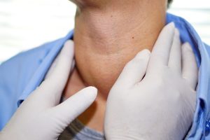 Gozzo: che cos&rsquo;&egrave;, sintomi, cause e cure del gozzo tiroideo