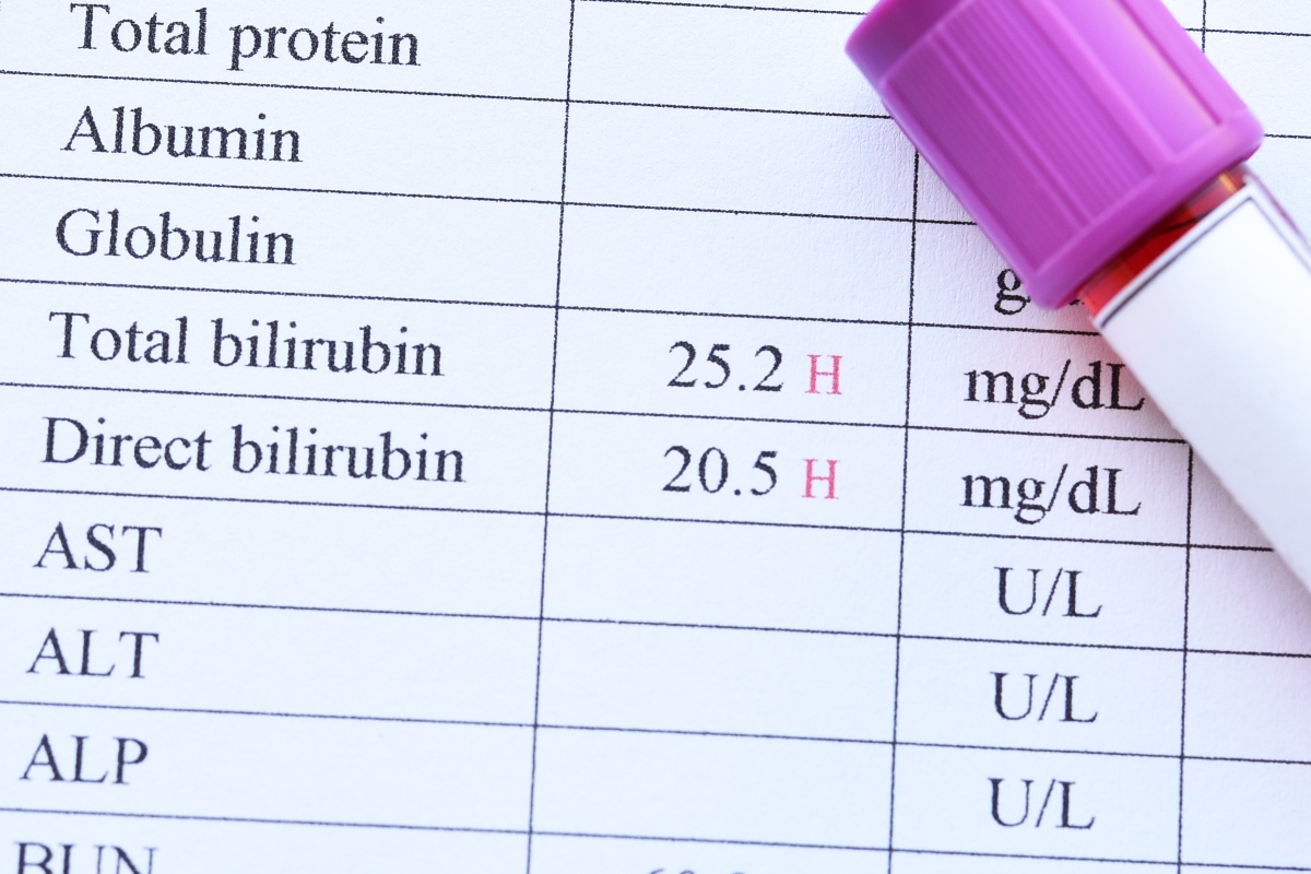 Ittero: cos’è, sintomi, tipologie, cause, diagnosi, cure e prevenzione 4 ittero: esami da fare