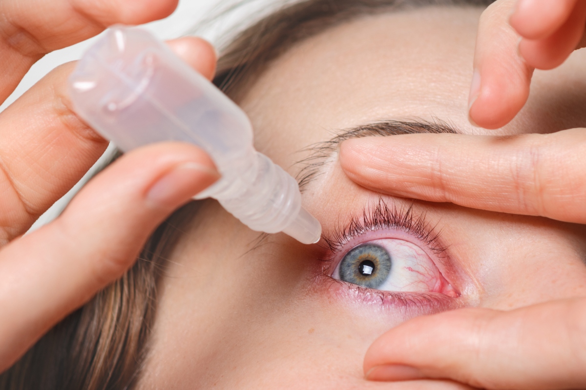 Sangue nell’occhio: cos’è, sintomi, cause, cosa fare e quando preoccuparsi 3 sangue nell'occhio: cure