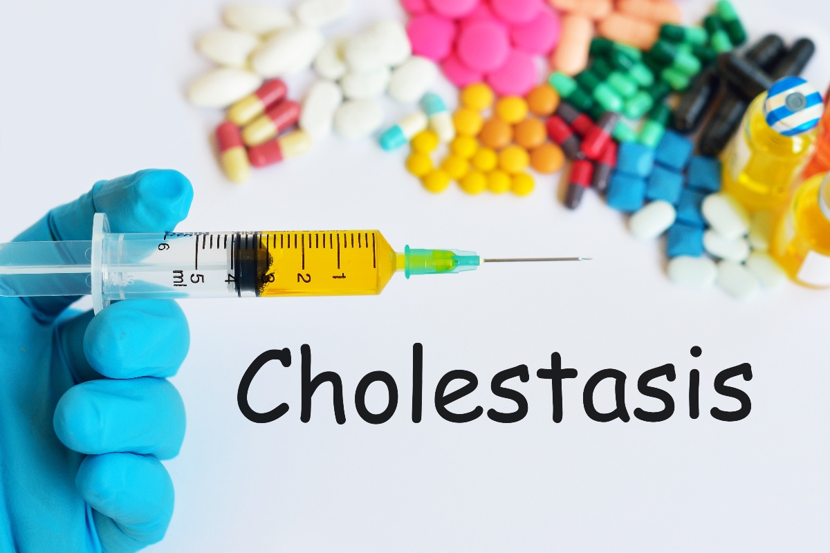 Colestasi: cos’è, sintomi, quali sono le cause, colestasi primaria e gravidica, diagnosi, cure e prevenzione 5 come curare la colestasi