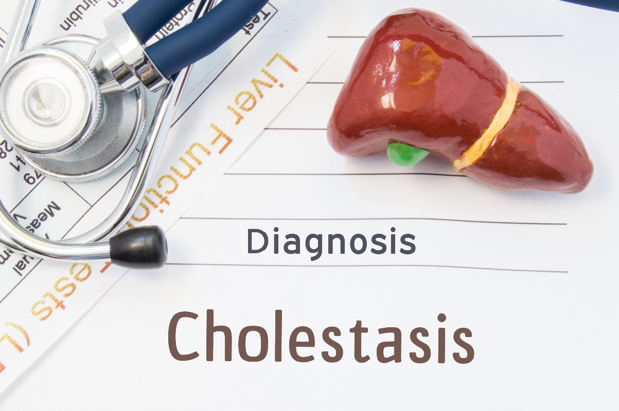 Colestasi: cos’è, sintomi, quali sono le cause, colestasi primaria e gravidica, diagnosi, cure e prevenzione 4 colestasi: diagnosi