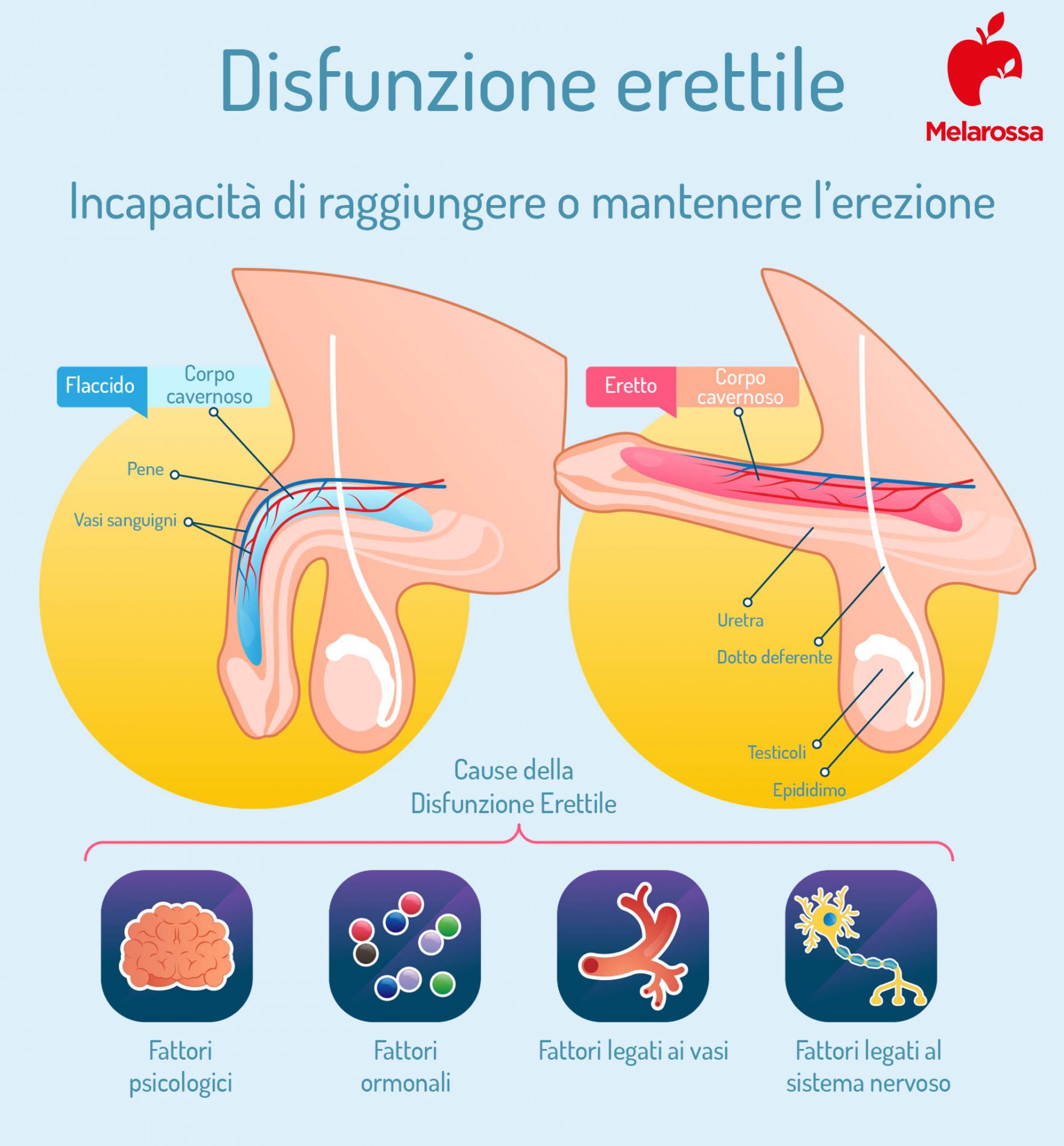 Disfunzione erettile o impotenza: cos’è, cause, sintomi, cure e rimedi dei problemi d'erezione 1 disfunzione erettile 1