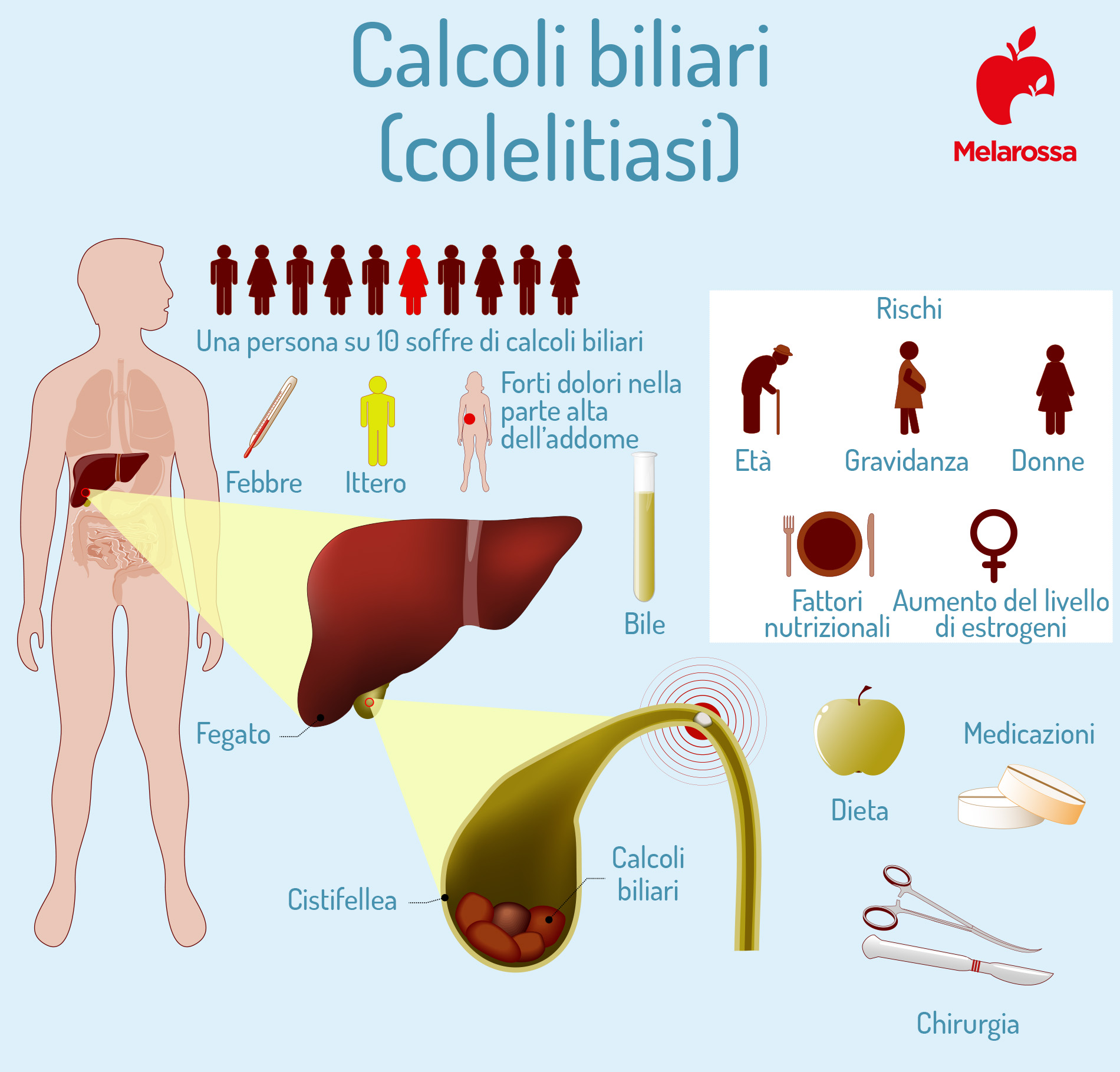 Calcoli biliari: cosa sono, classificazione, sintomi, cause, diagnosi e cura 3 calcoli biliari- Infografica