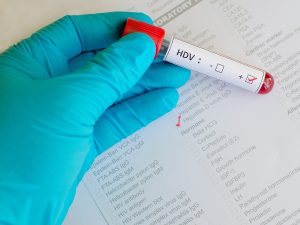 Epatite D: cos&rsquo;&egrave;, sintomi, cause, come avviene il contagio, diagnosi, cure e prevenzione