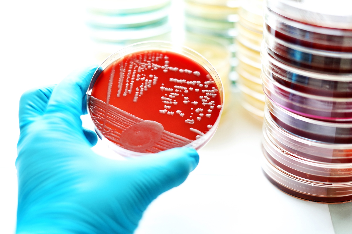 Agar agar, cos'è, a cosa serve, proprietà e benefici per la salute, valori nutrizionali, usi e ricette 10 agar agar Habitat