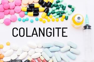 Colangite: cos&rsquo;&egrave;, sintomi, cause, diagnosi e trattamento