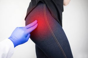 Coxartrosi: cos&rsquo;&egrave;, cause, sintomi, diagnosi  e cure dell&rsquo;artrosi dell&rsquo;anca
