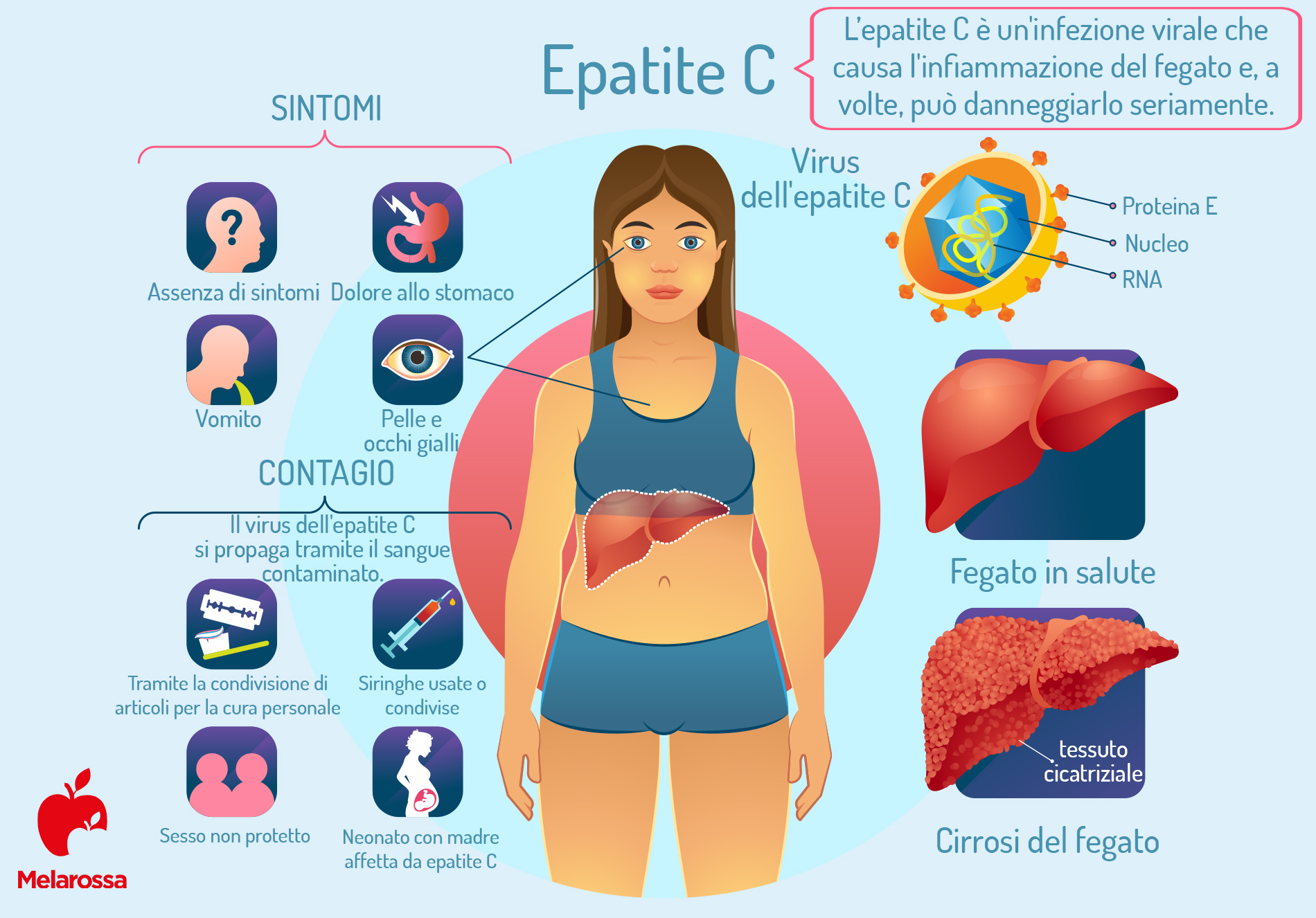 Epatite A, B, C, D e E: sintomi, come si trasmette e se si guarisce 3 Una grafica sui sintomi da epatite C