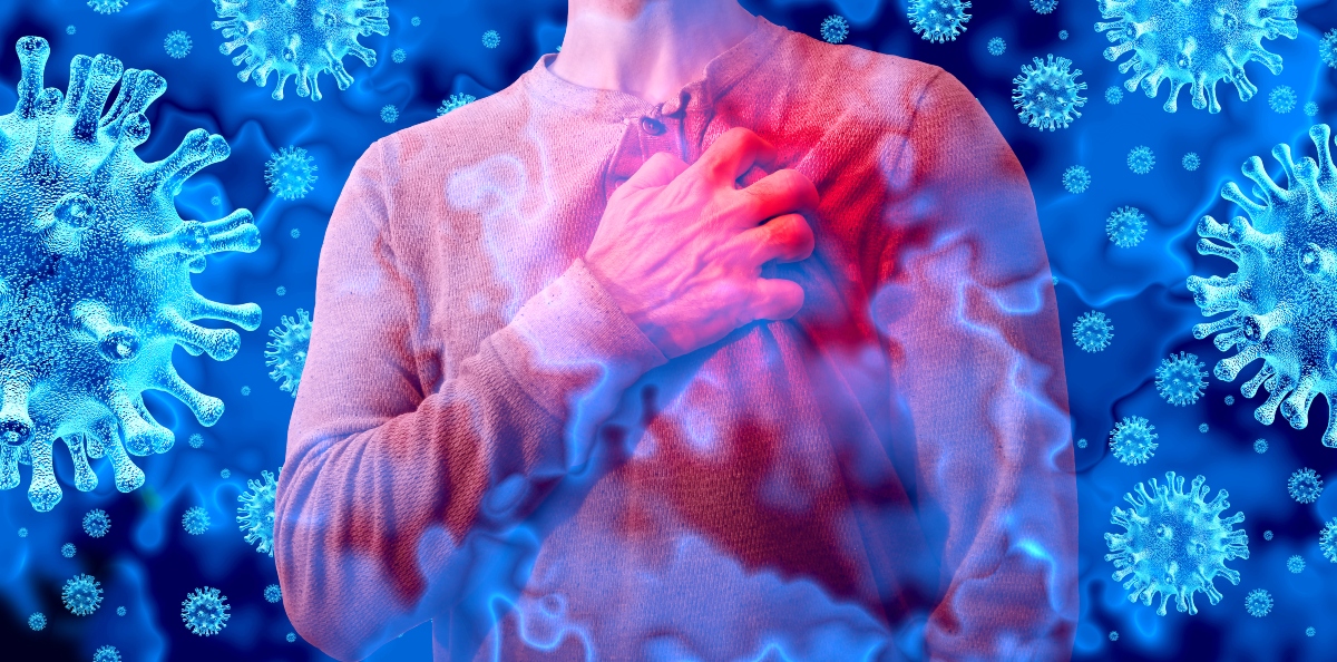 Miocardite: cos’è, sintomi, cause, diagnosi e cura 3 le cause della miocardite