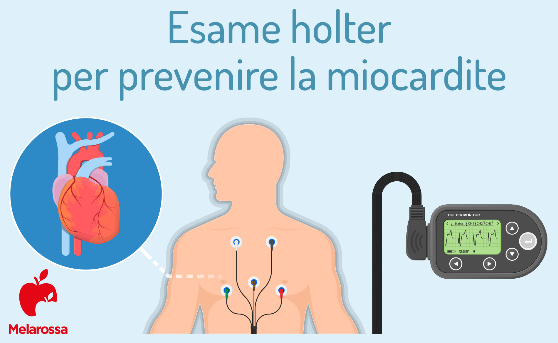 Miocardite: cos’è, sintomi, cause, diagnosi e cura 7 miocardite: esame holter per prevenire