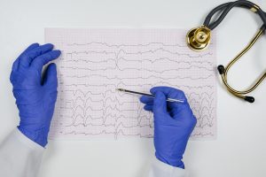 Extrasistole: cos&rsquo;&egrave;, tipi, cause, sintomi, diagnosi e cure