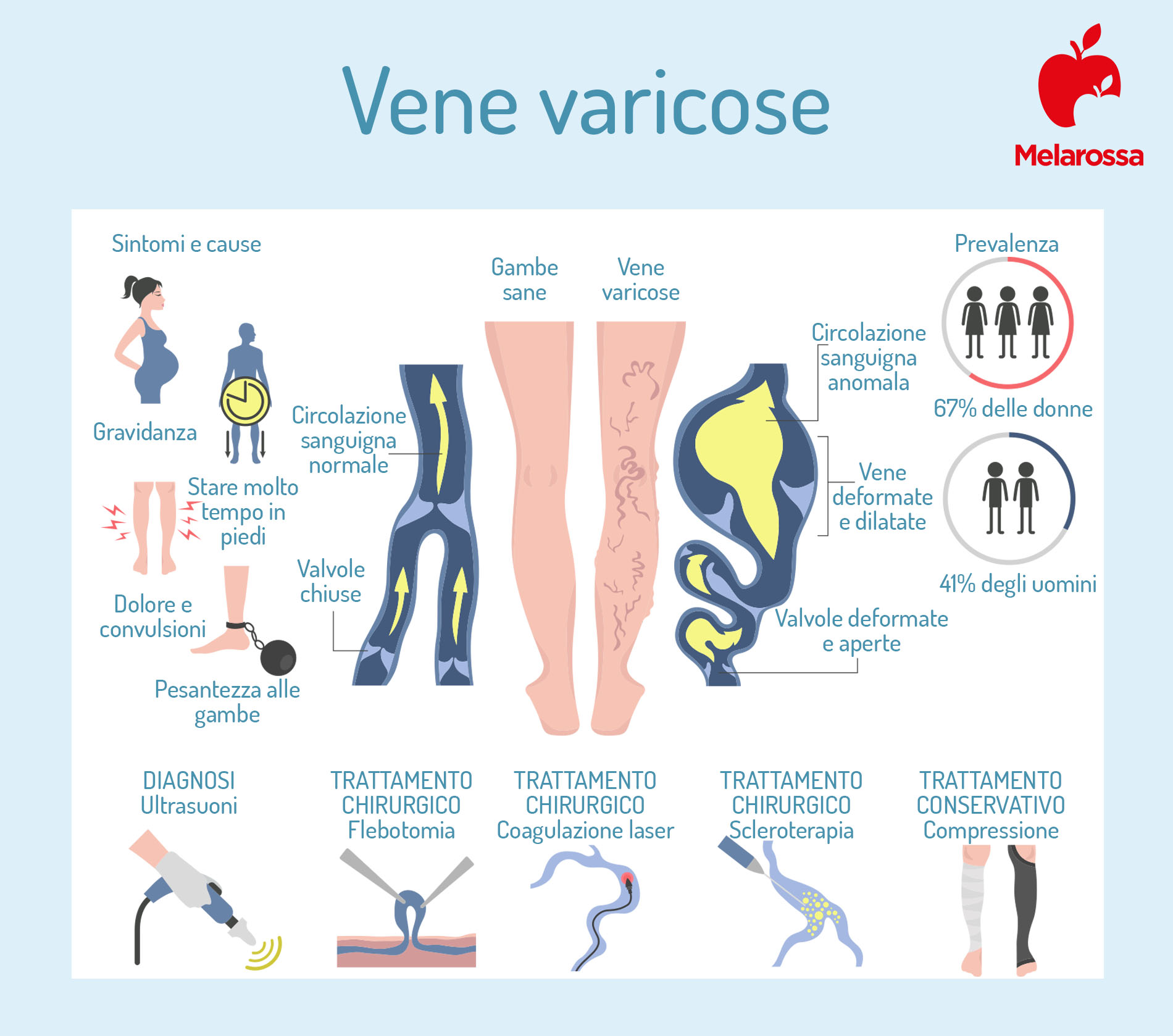 Vene varicose: cosa sono, sintomi, cause, cure e rimedi delle varici 3 vene varicose: cosa sono, sintomi, cause, cura