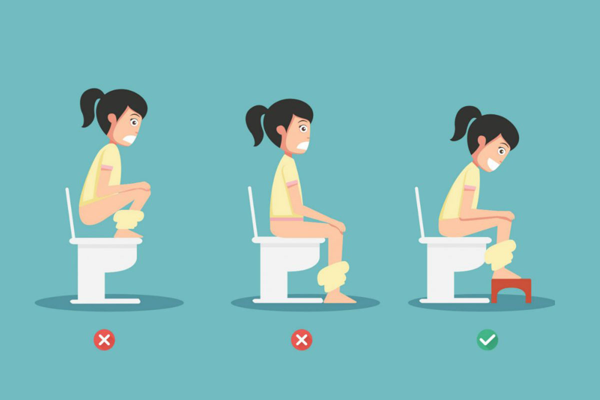 Emorroidi: cause e sintomi, cosa mangiare, cure e rimedi 9 emorroidi: posizione corretta per andare in bagno