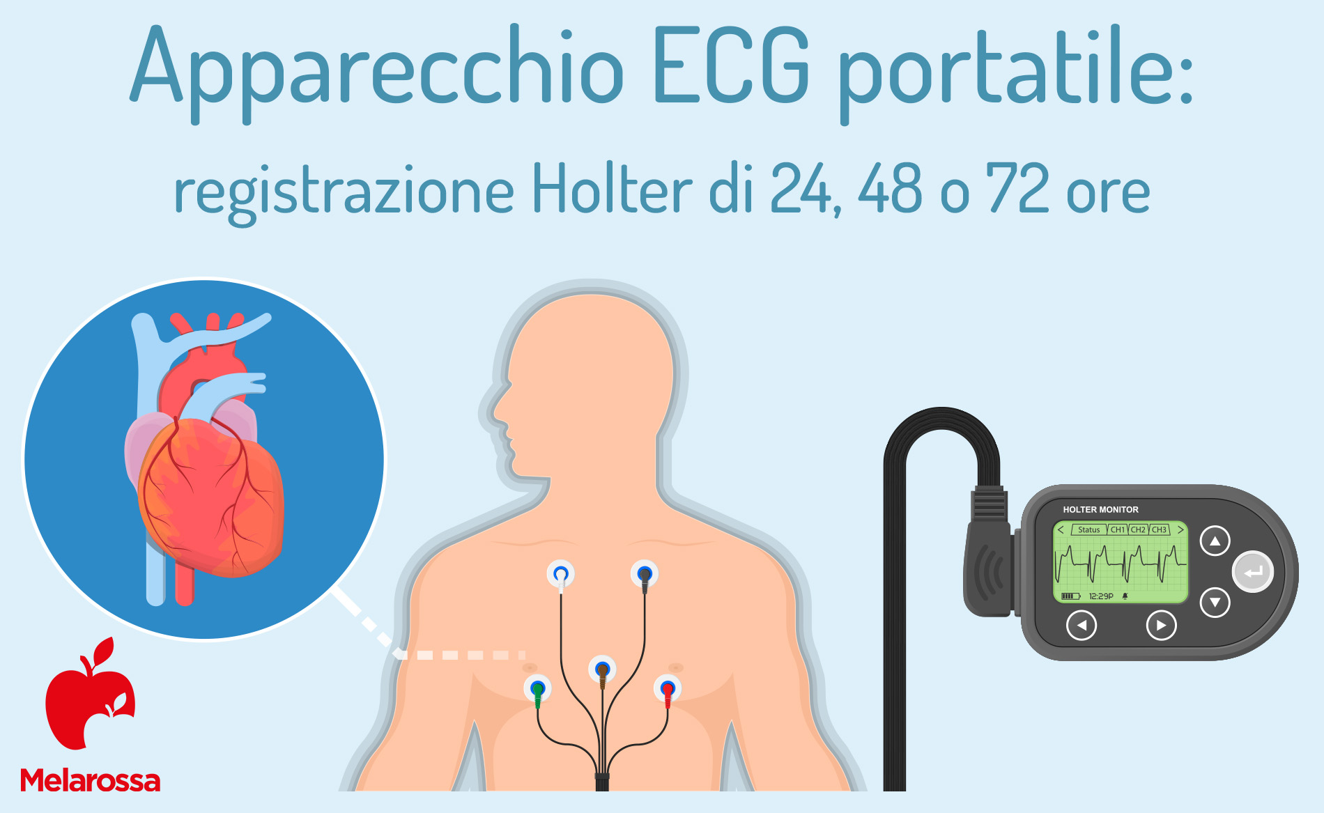 Elettrocardiogramma (ECG): cos'è, quando farlo e cosa si vede 1 elettrocardiogramma ECG: monitoraggio Holtler