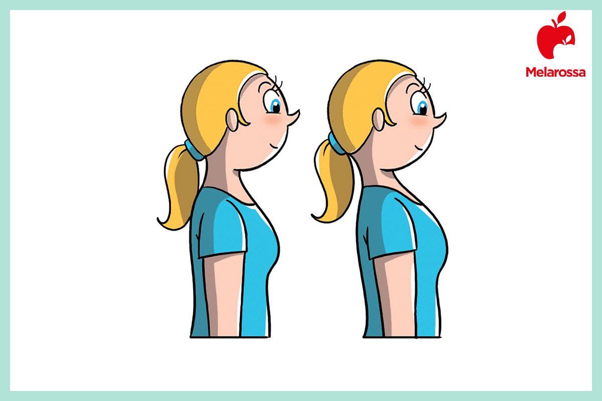 Cervicale: cause, sintomi e esercizi da fare a casa per prevenire il dolore 3 esercizi cervicale: mento rettrato