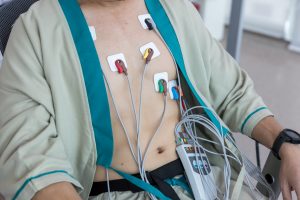 Bradicardia: che cos&rsquo;&egrave;, cause, sintomi, diagnosi, cure, quando preoccuparsi