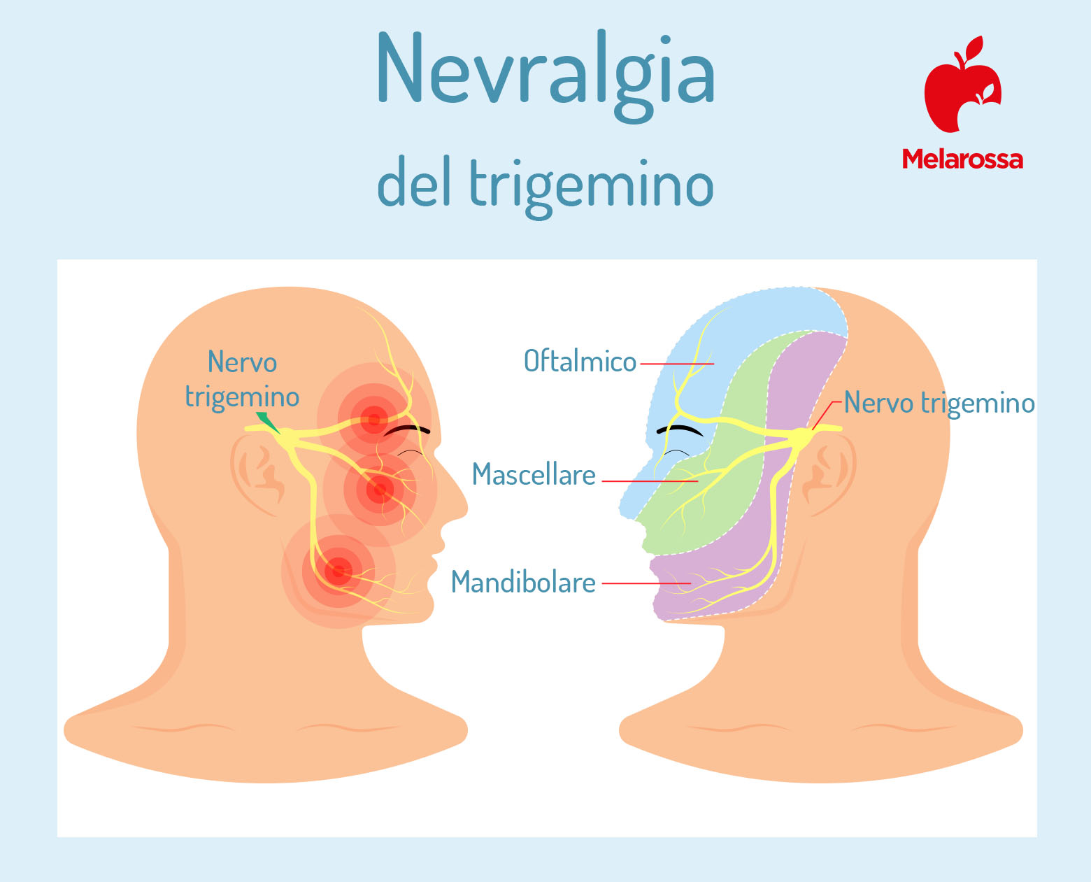 Nevralgia del trigemino: che cos'è, sintomi e cause, diagnosi e cura 2 nevralgia del trigemino: anatomia