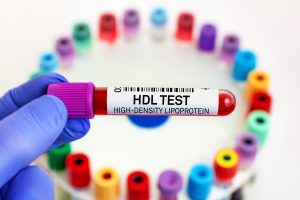 Colesterolo HDL (buono): che cos&rsquo;&egrave;, valori normali e cosa fare quando &egrave; alto o basso